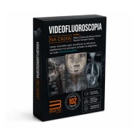 Videofluoroscopia Na Caixa Videofluoroscopia Na Caixa